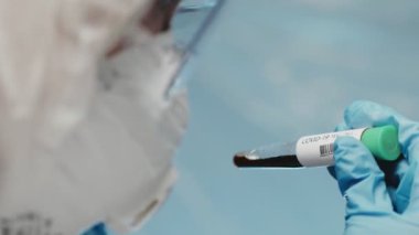Kan testinin sonucuna göre hızla yayılan yeni Coronavirus için mavi eldivenli mikrobiyolog ya da tıp çalışanı eli yakından inceleniyor. Salgın ve salgın COVID Pozitif kavram