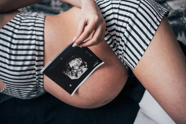 Těhotná žena s obrázkem ultrazvukového záznamu — Stock fotografie