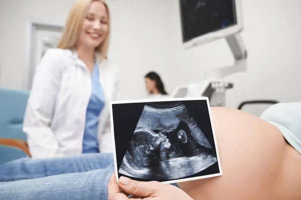Беременная женщина показывает рентген будущего ребенка . — стоковое фото