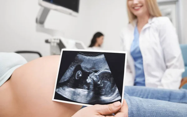 Gros plan de l'échographie du bébé dans les mains de la mère — Photo