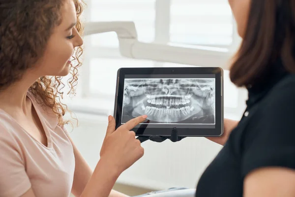 Selektive Fokussierung des Röntgenbildes der Zähne auf Tabletten — Stockfoto