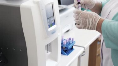 Yakın çekim otomatik kan testleri robot makine, tıbbi malzeme. Modern klinik tanı laboratuvar araçları hastanede çalışıyorum. Sağlık, tıp kavramı.