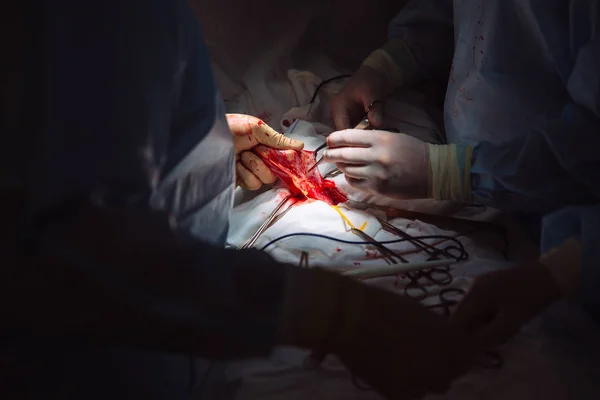 Mãos fechadas, equipe de doutores durante a cirurgia, instrumentos cirúrgicos em uma mesa médica em uma clínica. Tesoura estéril de metal, braçadeira, agulha cirúrgica na mesa ou na mão do médico. Conceito de saúde . — Fotografia de Stock