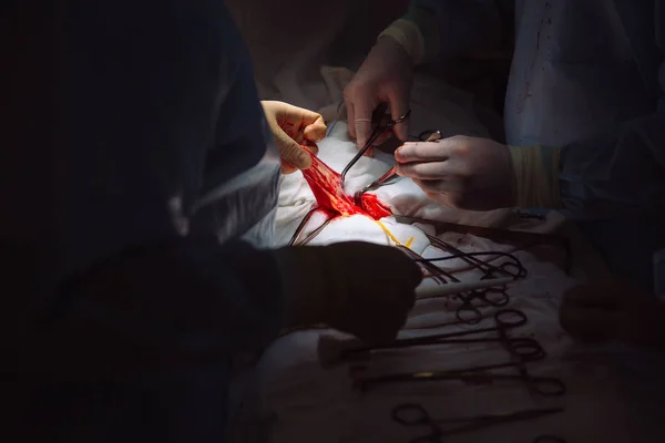 Close-up handen, team van artsen tijdens chirurgie, chirurgische instrumenten op een medische tafel in een kliniek. Metalen klem, steriele schaar, chirurgische naald aan tafel of in de hand van de arts. Begrip gezondheid. — Stockfoto