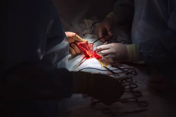 Mãos fechadas, equipe de doutores durante a cirurgia, instrumentos cirúrgicos em uma mesa médica em uma clínica. Tesoura estéril de metal, braçadeira, agulha cirúrgica na mesa ou na mão do médico. Conceito de saúde . — Fotografia de Stock