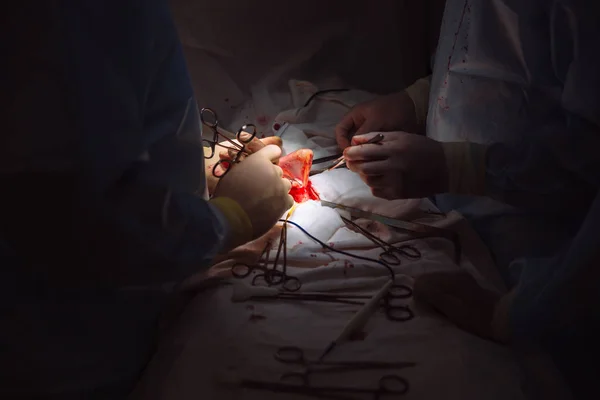 Primer plano de las manos, equipo de médicos durante la cirugía, instrumentos quirúrgicos en una mesa médica en una clínica. Tijeras metálicas estériles, pinza, aguja quirúrgica en la mesa o en la mano del médico. Concepto de salud . — Foto de Stock
