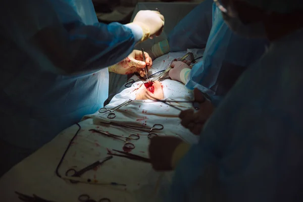 Mãos fechadas, equipe de doutores durante a cirurgia, instrumentos cirúrgicos em uma mesa — Fotografia de Stock