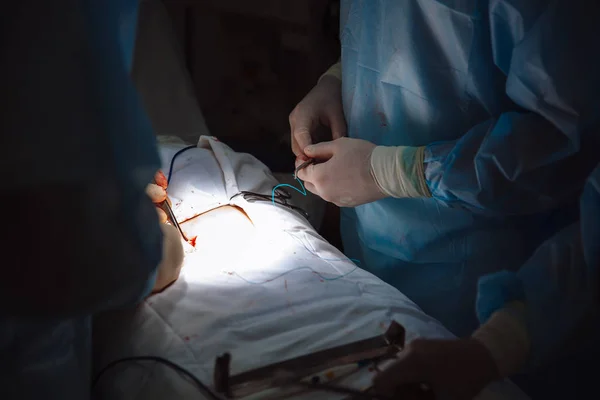 Detail ruce, tým lékařů během operace, chirurgické nástroje na stůl — Stock fotografie