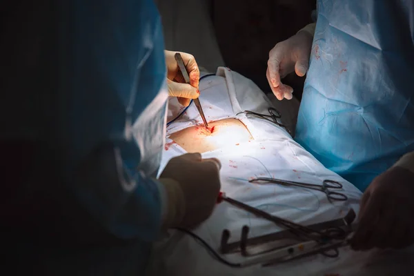 Mãos fechadas, equipe de doutores durante a cirurgia, instrumentos cirúrgicos em uma mesa — Fotografia de Stock