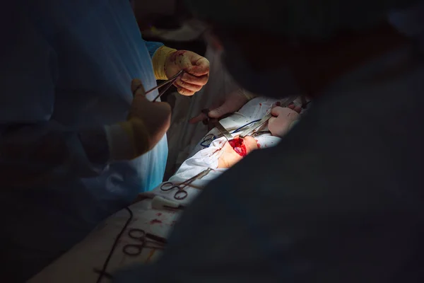 Mãos fechadas, equipe de doutores durante a cirurgia, instrumentos cirúrgicos em uma mesa — Fotografia de Stock