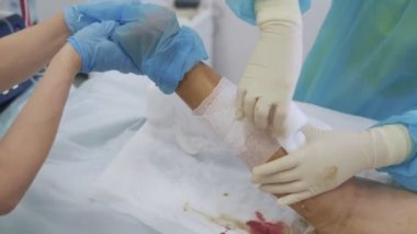 Yakın çekim cerrah elleri steril eldiven bandaj hasta bacak varisli damarların kaldırılması işleminden sonra