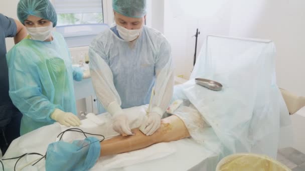 Chirurgien insère un instrument spécial dans la jambe du patient et fait des ultrasons lors de l’enlèvement des varices — Video