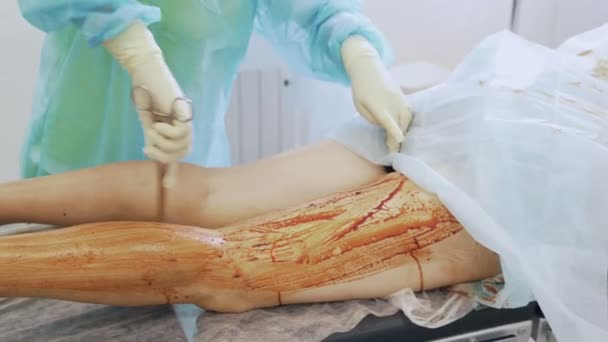 Närbild sjuksköterska hand desinfekterar patient benet före operationen i operationssalen — Stockvideo