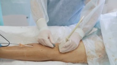 Yakın yukarı phlebologist hasta bacak özel enstrüman tanıttı ve çalışma sırasında ultrason yapar
