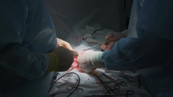 Yakın çekim cerrahlar eller özel aletler, düşük ışık sahnesi ile hastaya karın cerrahisi yapmak — Stok video