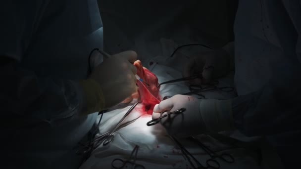 Gros plan médecins mains faire une chirurgie abdominale au patient avec des instruments spéciaux, scène de faible luminosité — Video