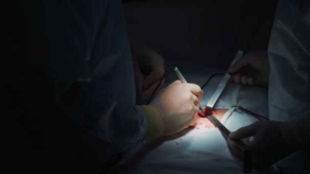 Close-up surgeons hands make abdominal surgery to patient with special instruments, low light scene — Stock Video