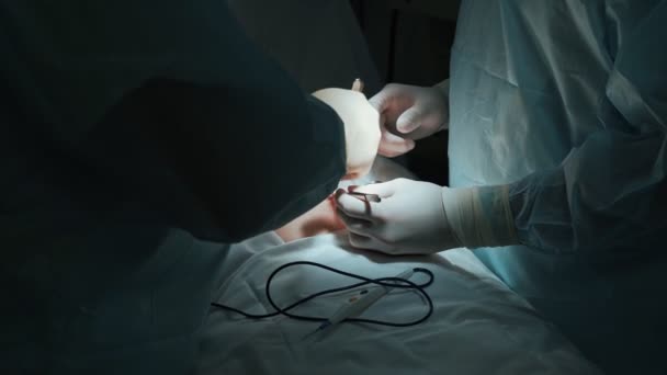 Close-up surgeons hands make abdominal surgery to patient, low light scene. Slow motion — Stock Video