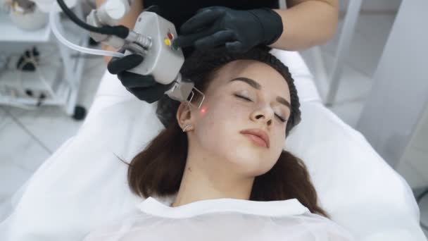 Κλείστε το πρόσωπο της νεαρής γυναίκας στη διαδικασία ξεφλούδισμα του προσώπου με λέιζερ, αργή κίνηση — Αρχείο Βίντεο