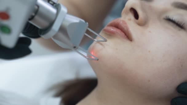 Close-up rosto de mulher jovem no procedimento de descascamento facial a laser, câmera lenta — Vídeo de Stock