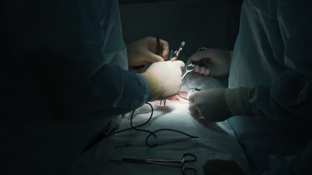 Close-up surgeons hands make surgery to patient with special instruments, slow motion — Stock Video