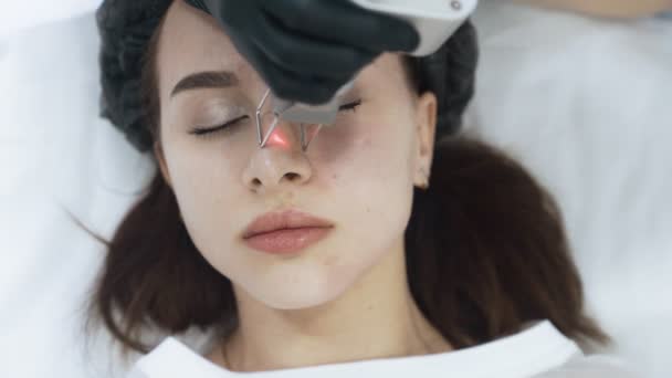 Κοντινό σχέδιο γυναίκα πρόσωπο σε Laser απολέπιση προσώπου με ειδική συσκευή, αργή κίνηση — Αρχείο Βίντεο