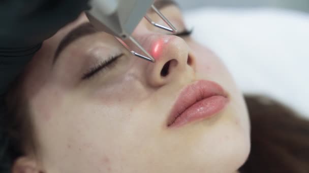Крупним планом обличчя молодої жінки на процедурі лазерного пілінгу обличчя, повільний рух — стокове відео