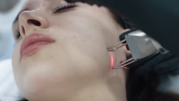 Bliska twarz młodej kobiety na laserowej twarzy peeling procedury, zwolnionym tempie — Wideo stockowe
