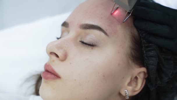Cerca de la cara de la mujer joven en el procedimiento de pelado facial con láser, cámara lenta — Vídeos de Stock