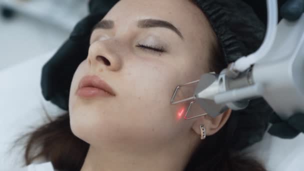 Zbliżenie twarzy kobiety na laserowe peeling twarzy ze specjalnym urządzeniem, zwolnionym tempie — Wideo stockowe
