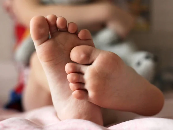 Children's feet are very close. Orthopedics and health. — Stock Photo, Image