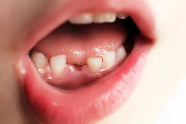 Dětský Úsměv Bez Zubu Tak Blízko — Stock fotografie