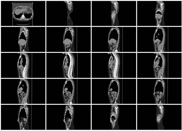 Taraması Adım Set Vücut Sagittal Görünümü — Stok fotoğraf