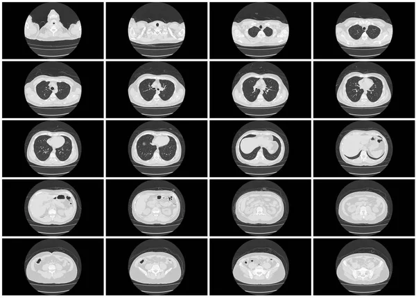 Scan Step Set Upper Body Lung Axial Top View — Stock Photo, Image