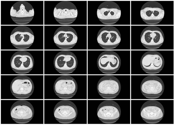 КТ шаг набор верхней части тела оси легкого вид сверху
