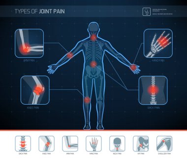 Eklem ağrısı tıbbi Infographic simgelerle türleri