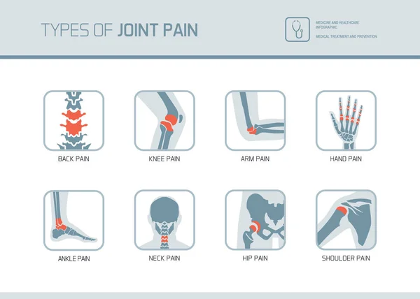 关节疼痛医学图标集的类型 — 图库矢量图片
