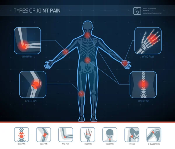 関節の痛み医療インフォ グラフィック アイコンの種類 — ストックベクタ