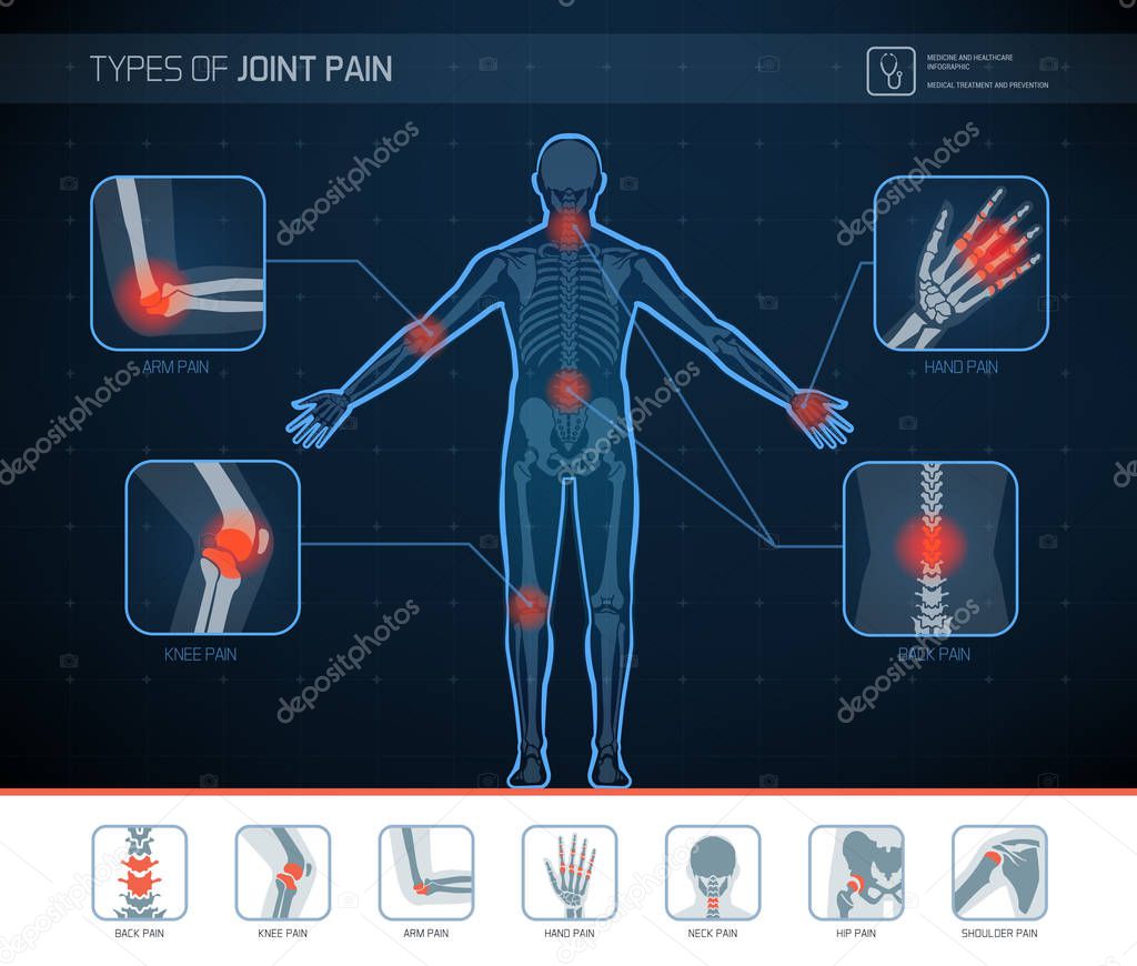 Types of joint pain medical infographic with icons