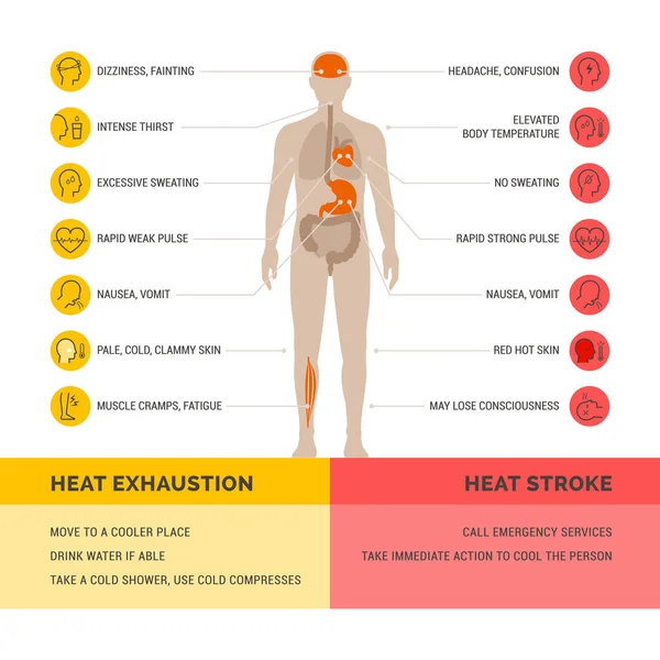 Θερμική Εξάντληση Και Θερμοπληξία Infographic Υγειονομικής Περίθαλψης Συμπτώματα Και Πρώτες — Διανυσματικό Αρχείο