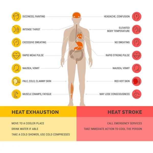 Infografica Sanitaria Esaurimento Termico Colpo Calore Sintomi Pronto Soccorso — Vettoriale Stock