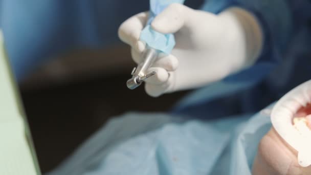 Imagem de perto da mão dentistas, segurando instrumento dentário — Vídeo de Stock