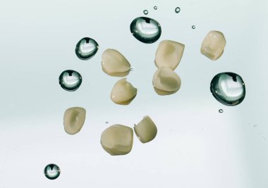 Kaplama kron protez. Diş seramik kaplama ve kron