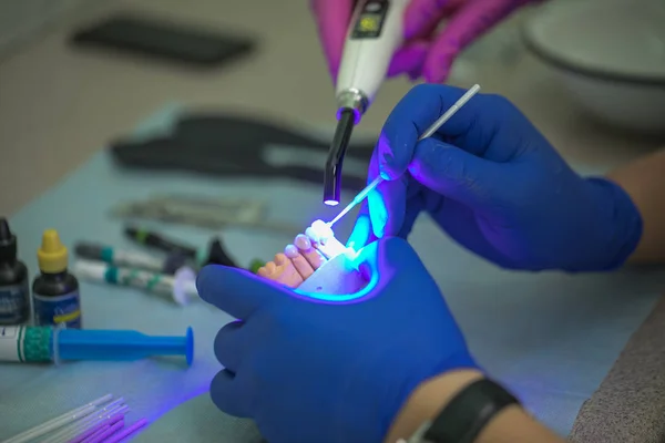 Mãos protéticas enquanto trabalhava na dentadura, dentes falsos, um estudo e uma mesa com ferramentas dentárias — Fotografia de Stock