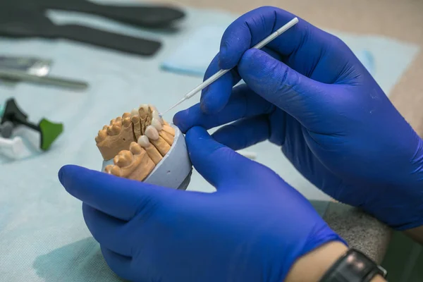 Zahnersatz, Prothesen, Prothesen funktionieren. Prothetik Hände während der Arbeit an der Prothese, eine Studie und ein Tisch mit zahnärztlichen Werkzeugen — Stockfoto