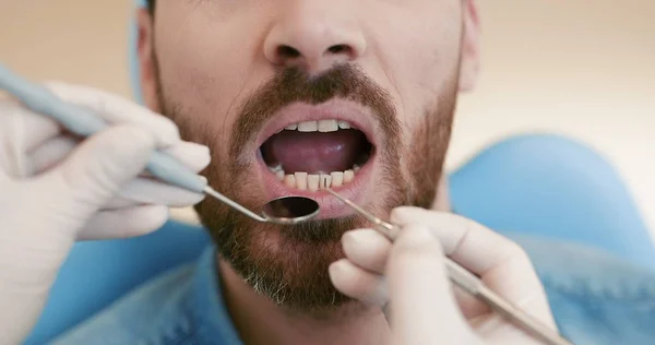 Primer plano de la boca abierta del paciente durante el chequeo oral con espejo cerca de — Foto de Stock