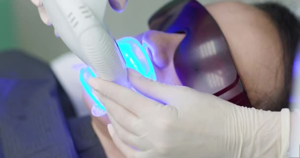 Tandarts doet tanden bleken procedure met ultraviolette lamp. Concept van tandverzorging en tandheelkunde. Tanden bleken met behulp van een ultraviolette lamp — Stockvideo