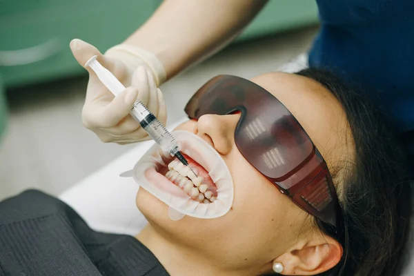Mujer joven con un expansor en la boca en la clínica dental. Hermosa sonrisa. La salud de los dientes. Estomatólogo dentista blanqueamiento de dientes para el paciente en la clínica dental de medicina . — Foto de Stock