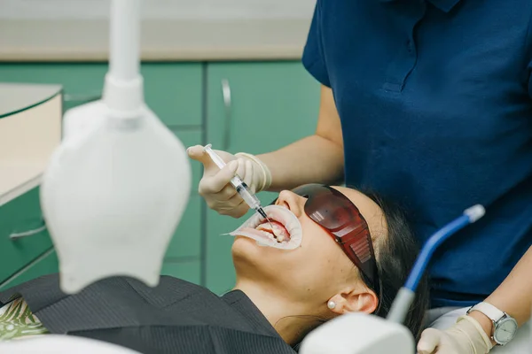 Dentista estomatologista clareamento dos dentes para o paciente. Aplicação de gel clareador protetor para os dentes. Mulher com um expansor na boca na clínica dentária. Belo sorriso. A saúde dos dentes — Fotografia de Stock