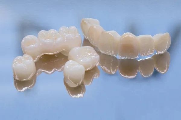 Metallfreie keramische Zahnkronen. Keramisches Zirkonium in der Endversion. Färben und Verglasen. Präzise Konstruktion und hochwertige Materialien — Stockfoto